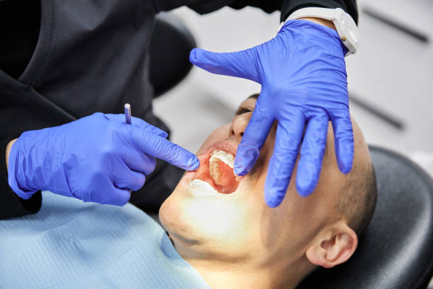 Best Emergency Wisdom Tooth Extraction in Peridot, AZ